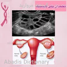 گردنبند مروارید